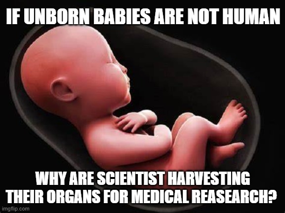 University of Pittsburgh likely harvesting organs from abortion survivors, with quota for racial minorities | IF UNBORN BABIES ARE NOT HUMAN; WHY ARE SCIENTIST HARVESTING THEIR ORGANS FOR MEDICAL REASEARCH? | made w/ Imgflip meme maker