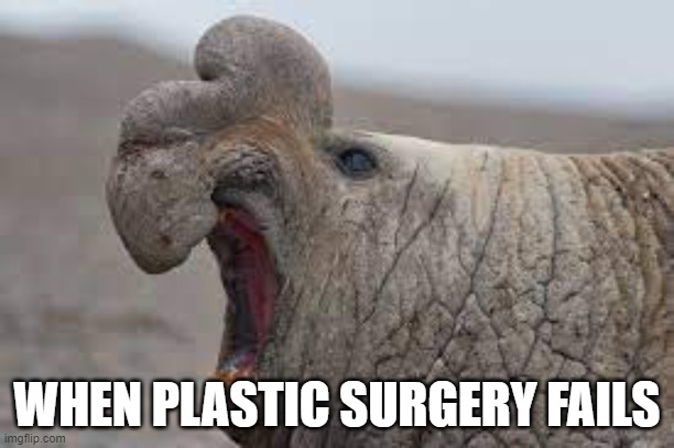 plastic surgery | WHEN PLASTIC SURGERY FAILS | image tagged in seal,plastic surgery | made w/ Imgflip meme maker