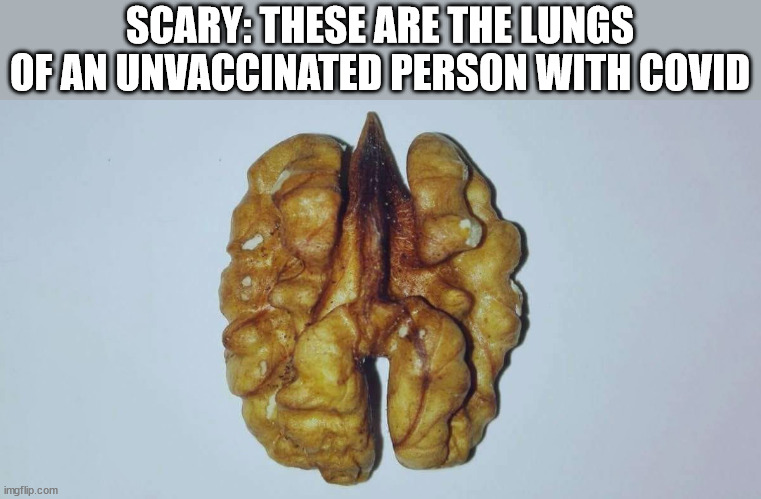 borrowed bty scary | SCARY: THESE ARE THE LUNGS OF AN UNVACCINATED PERSON WITH COVID | image tagged in covid-19 | made w/ Imgflip meme maker
