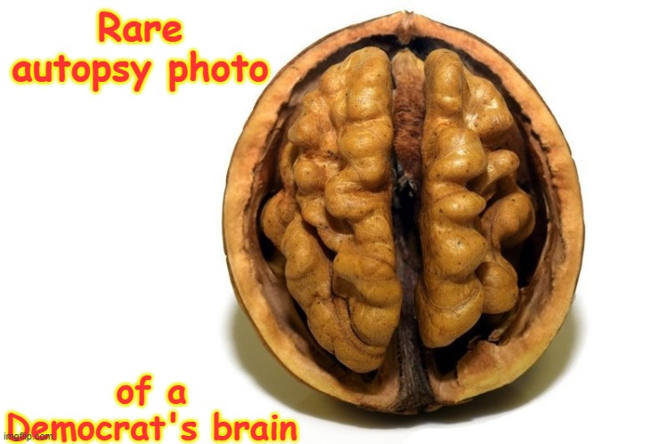 See? They really ARE Nuts! | Rare autopsy photo; of a Democrat's brain | image tagged in democrats,brains,memes,political meme | made w/ Imgflip meme maker