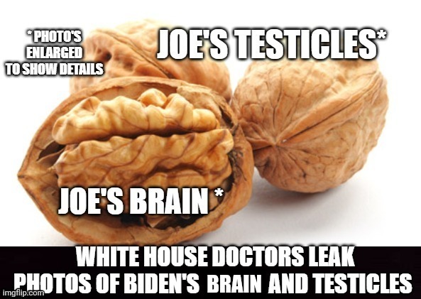 Leaked photos of Bidens brain and testicles | BRAIN | image tagged in biden | made w/ Imgflip meme maker