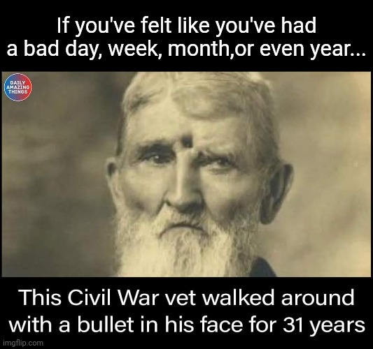 Dude... | If you've felt like you've had a bad day, week, month,or even year... | image tagged in civil war,veteran,bullet,head,hard,bad day | made w/ Imgflip meme maker