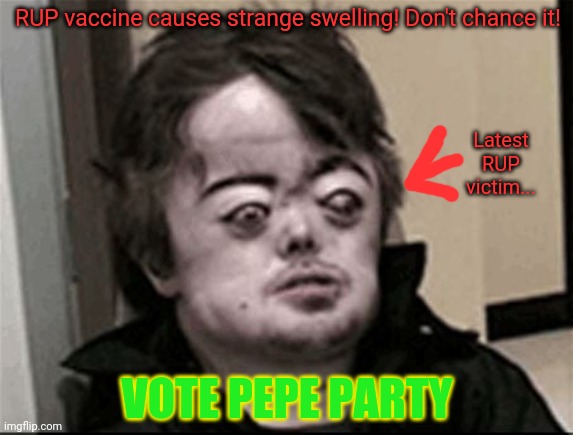 RUP vaccine causes strange swelling! Don't chance it! VOTE PEPE PARTY Latest RUP victim... | made w/ Imgflip meme maker
