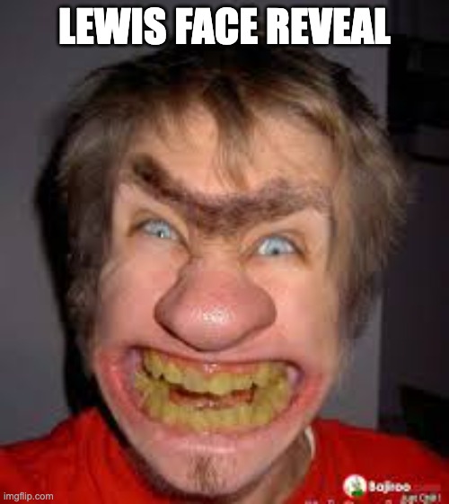 ugly guy | LEWIS FACE REVEAL | image tagged in ugly guy | made w/ Imgflip meme maker