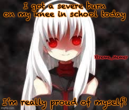 I’m really proud of myself! | I got a severe burn on my knee in school today; Xtreme_Memer; I’m really proud of myself! | image tagged in xtreme_memer s announcement template | made w/ Imgflip meme maker
