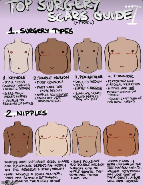 Top surgery guides | image tagged in if this gets marked nsfw,i will not be happy | made w/ Imgflip meme maker