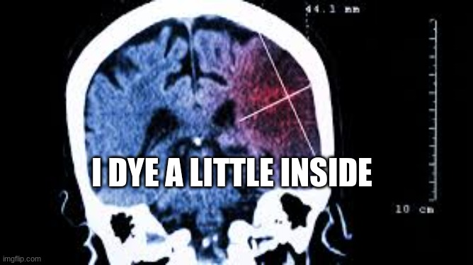 Every Time I Have An MRI... | I DYE A LITTLE INSIDE | image tagged in funny,pun,meme,humor,mri,joke | made w/ Imgflip meme maker
