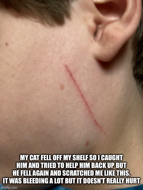 He didn’t mean to scratch me, just got scared | MY CAT FELL OFF MY SHELF SO I CAUGHT HIM AND TRIED TO HELP HIM BACK UP BUT HE FELL AGAIN AND SCRATCHED ME LIKE THIS. IT WAS BLEEDING A LOT BUT IT DOESN’T REALLY HURT | made w/ Imgflip meme maker