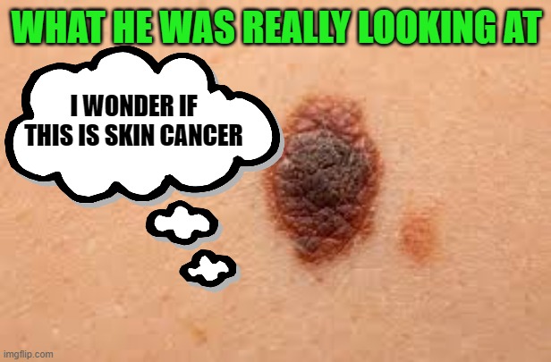 WHAT HE WAS REALLY LOOKING AT I WONDER IF THIS IS SKIN CANCER | made w/ Imgflip meme maker