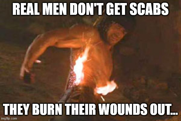 Real Men | REAL MEN DON'T GET SCABS; THEY BURN THEIR WOUNDS OUT... | image tagged in burn,rambo,wounds | made w/ Imgflip meme maker
