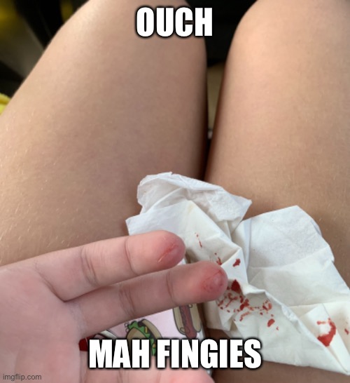 Btw, I said fingies as in fingers | OUCH; MAH FINGIES | image tagged in oof,ouch,fingers | made w/ Imgflip meme maker