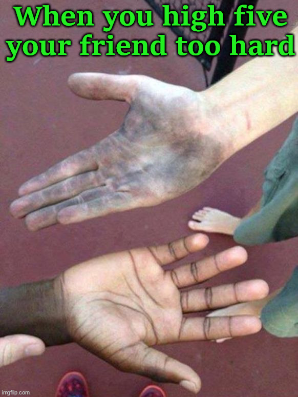 When you high five your friend too hard | image tagged in dark humor | made w/ Imgflip meme maker
