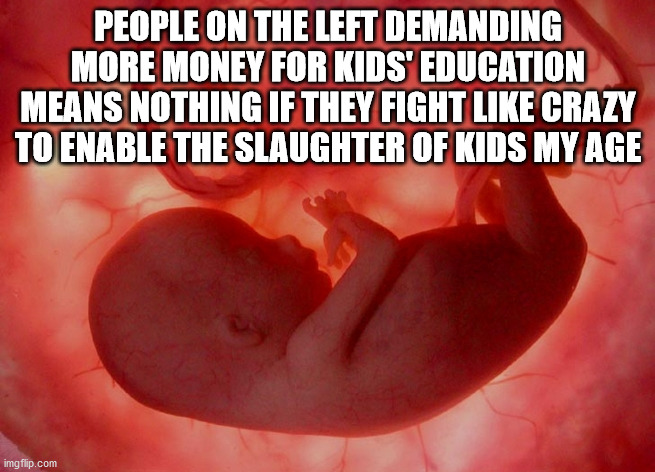 fetus | PEOPLE ON THE LEFT DEMANDING MORE MONEY FOR KIDS' EDUCATION MEANS NOTHING IF THEY FIGHT LIKE CRAZY TO ENABLE THE SLAUGHTER OF KIDS MY AGE | image tagged in fetus | made w/ Imgflip meme maker