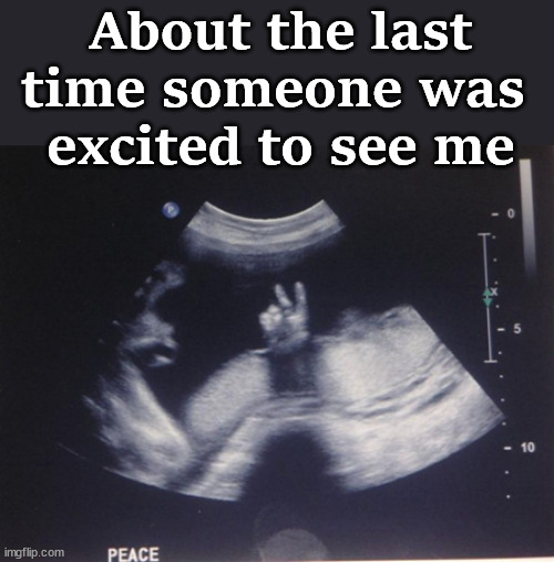 Ultrasound | About the last time someone was 
excited to see me | image tagged in ultrasound | made w/ Imgflip meme maker