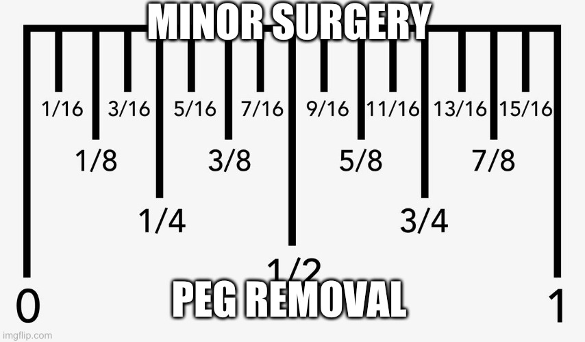 meta apologies | MINOR SURGERY PEG REMOVAL | image tagged in inch | made w/ Imgflip meme maker