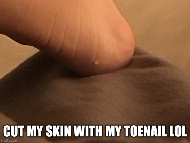 CUT MY SKIN WITH MY TOENAIL LOL | made w/ Imgflip meme maker