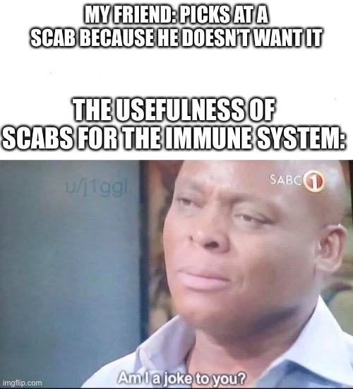 am I a joke to you | MY FRIEND: PICKS AT A SCAB BECAUSE HE DOESN’T WANT IT; THE USEFULNESS OF SCABS FOR THE IMMUNE SYSTEM: | image tagged in am i a joke to you | made w/ Imgflip meme maker