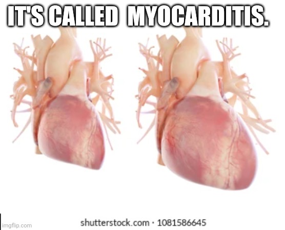 IT'S CALLED  MYOCARDITIS. | made w/ Imgflip meme maker