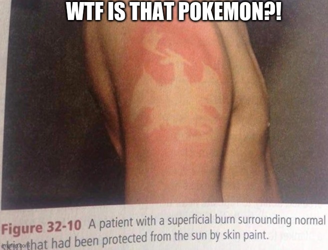 wtf is that pokemon | WTF IS THAT POKEMON?! | image tagged in lol,lmao,skin,drawing,science | made w/ Imgflip meme maker