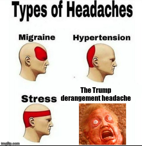 Types of Headaches meme | The Trump derangement headache | image tagged in types of headaches meme | made w/ Imgflip meme maker