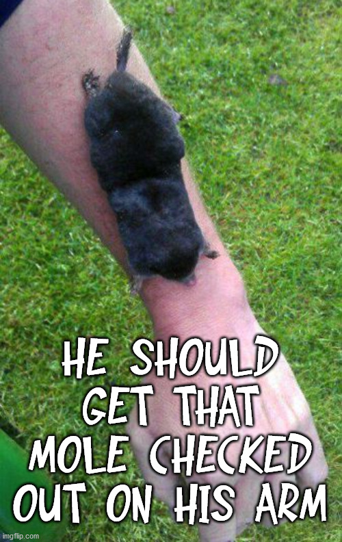 HE SHOULD GET THAT MOLE CHECKED OUT ON HIS ARM | image tagged in eyeroll | made w/ Imgflip meme maker