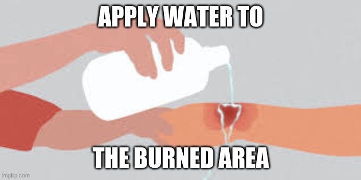 APPLY WATER TO THE BURNED AREA | made w/ Imgflip meme maker