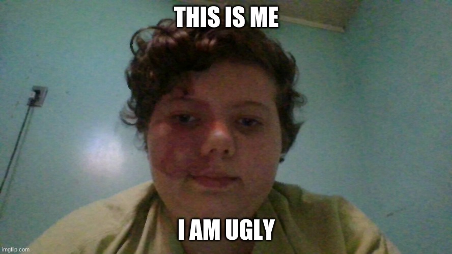 me | THIS IS ME; I AM UGLY | image tagged in me | made w/ Imgflip meme maker