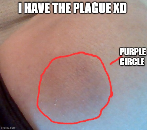 I HAVE THE PLAGUE XD; PURPLE CIRCLE | made w/ Imgflip meme maker