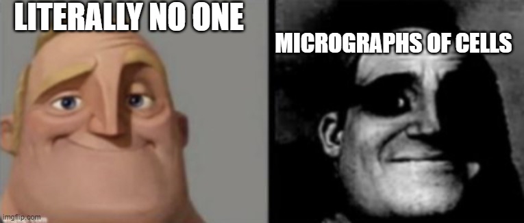people who know and dont know | LITERALLY NO ONE; MICROGRAPHS OF CELLS | image tagged in people who know and dont know | made w/ Imgflip meme maker