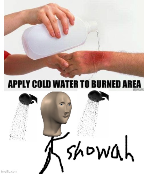 apply cold water to burned area extra | image tagged in apply cold water to burned area extra | made w/ Imgflip meme maker