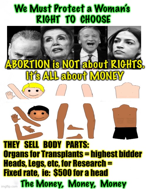 Your Rights?  Or…. Their Money—What’s it Really About? | We Must Protect a Woman’s 
RIGHT  TO  CHOOSE; ABORTION is NOT about RIGHTS.
It’s ALL about MONEY; THEY   SELL   BODY   PARTS:
Organs for Transplants = highest bidder
Heads, Legs, etc, for Research = 
Fixed rate,  ie:  $500 for a head; The Money,  Money,  Money | image tagged in memes,rights,money | made w/ Imgflip meme maker
