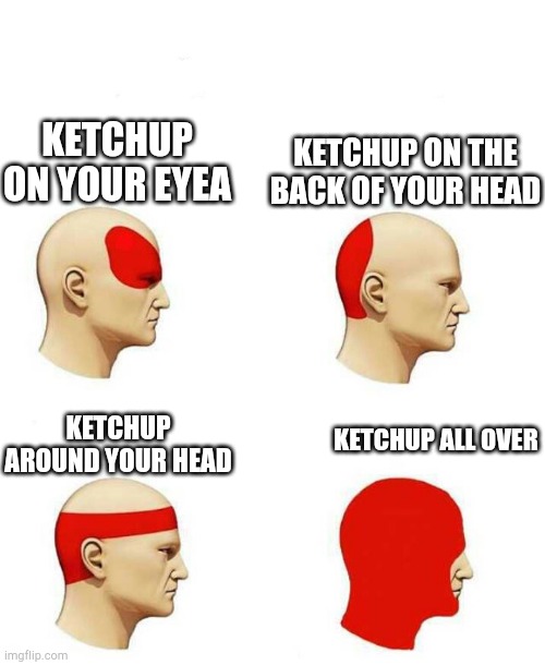 Look at the comments | KETCHUP ON YOUR EYEA; KETCHUP ON THE BACK OF YOUR HEAD; KETCHUP ALL OVER; KETCHUP AROUND YOUR HEAD | image tagged in types of headache,ketchup,types of headaches meme,headache | made w/ Imgflip meme maker