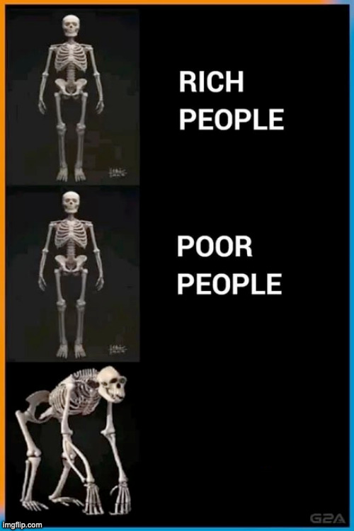 Abnormal human skeleton Blank Meme Template