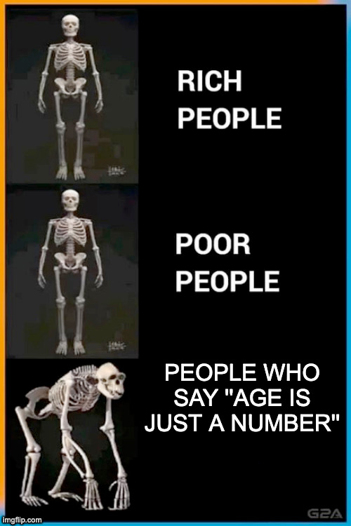 Seriously | PEOPLE WHO SAY ''AGE IS JUST A NUMBER'' | image tagged in abnormal human skeleton | made w/ Imgflip meme maker