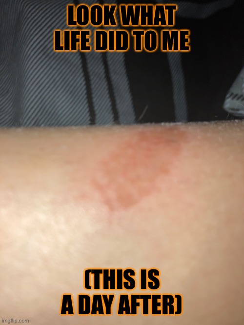 Add THIS to the list of crimes! |  LOOK WHAT LIFE DID TO ME; (THIS IS A DAY AFTER) | image tagged in o | made w/ Imgflip meme maker
