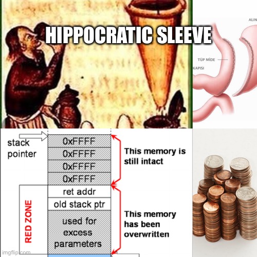 Sleeve Gastrectomy |  HIPPOCRATIC SLEEVE | image tagged in greek,hypocrisy,computation,change,filtration | made w/ Imgflip meme maker
