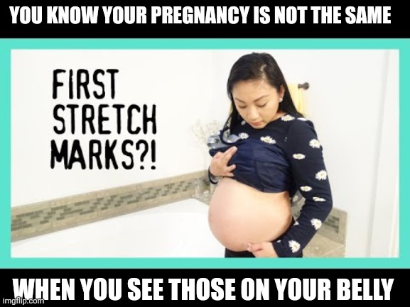 YOU KNOW YOUR PREGNANCY IS NOT THE SAME; WHEN YOU SEE THOSE ON YOUR BELLY | image tagged in pregnant,stretch marks | made w/ Imgflip meme maker