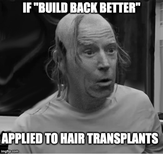 BUILD BACK BETTER | IF "BUILD BACK BETTER"; APPLIED TO HAIR TRANSPLANTS | image tagged in biden,build back better,bad hair day | made w/ Imgflip meme maker