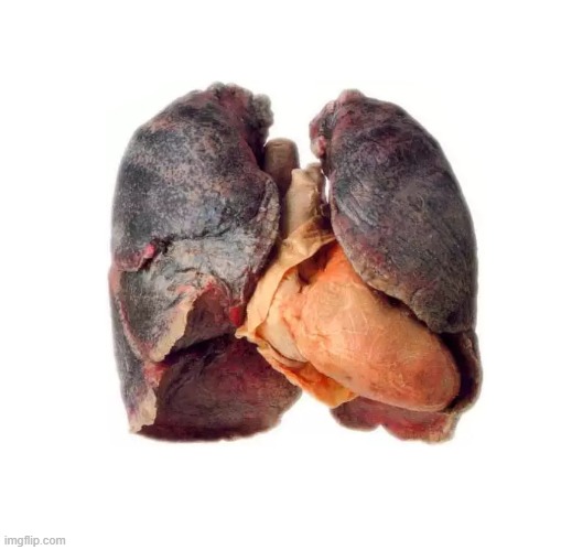 Smoker sick unhealthy lungs | image tagged in smoker sick unhealthy lungs | made w/ Imgflip meme maker