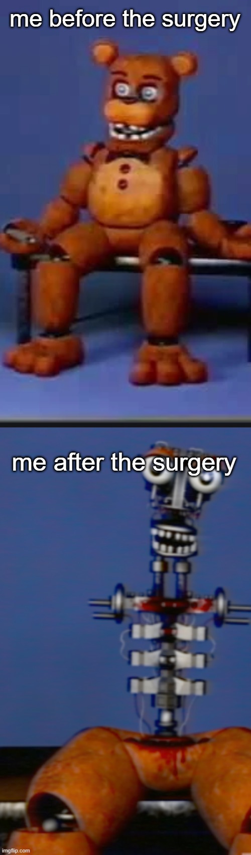 very violent | me before the surgery; me after the surgery | image tagged in memes,fnaf,vhs | made w/ Imgflip meme maker