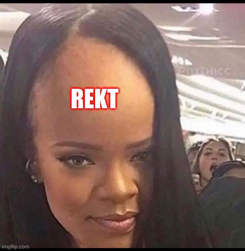 Rekt forehead | REKT | image tagged in forehead | made w/ Imgflip meme maker