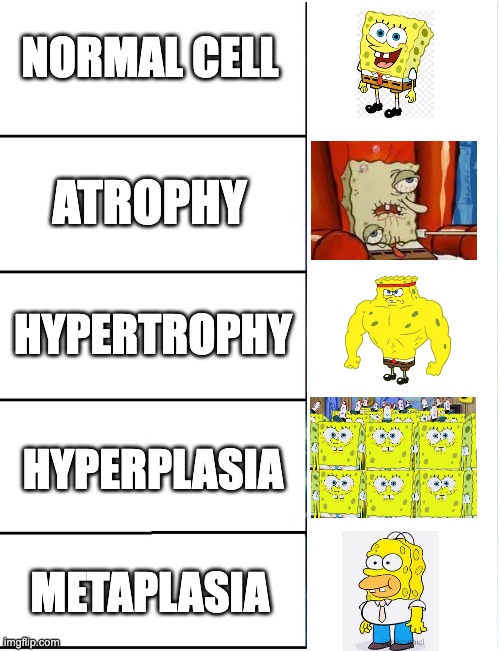 cellular response to injury | NORMAL CELL; ATROPHY; HYPERTROPHY; HYPERPLASIA; METAPLASIA | image tagged in biology,spongebob,hyperplasia,atrophy,hypertrophy,metaplasia | made w/ Imgflip meme maker
