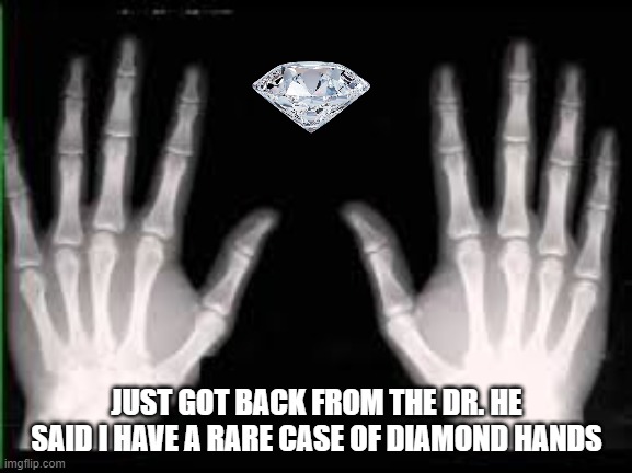 Diamond Hands | JUST GOT BACK FROM THE DR. HE SAID I HAVE A RARE CASE OF DIAMOND HANDS | image tagged in diamond hands,nft,ethereum | made w/ Imgflip meme maker