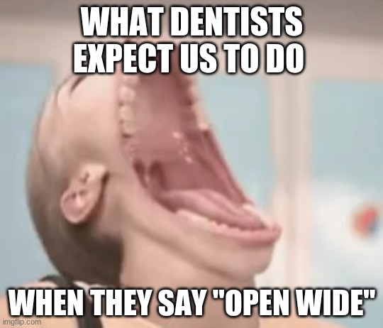fr tho | WHAT DENTISTS EXPECT US TO DO; WHEN THEY SAY "OPEN WIDE" | image tagged in memes,why | made w/ Imgflip meme maker