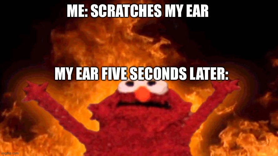 True story | ME: SCRATCHES MY EAR; MY EAR FIVE SECONDS LATER: | image tagged in elmo fire | made w/ Imgflip meme maker