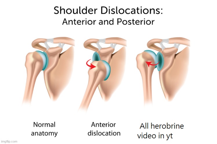 Shoulder dislocation | image tagged in memes,unknown | made w/ Imgflip meme maker