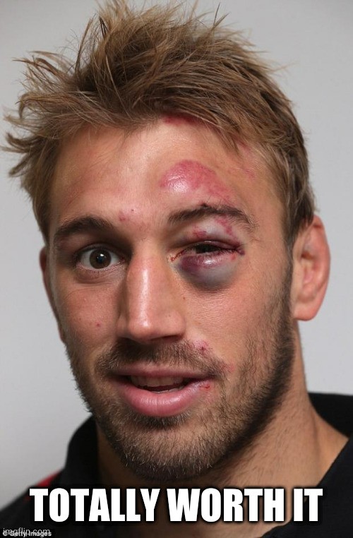black eye | TOTALLY WORTH IT | image tagged in black eye | made w/ Imgflip meme maker