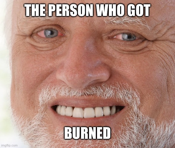 Hide the Pain Harold | THE PERSON WHO GOT BURNED | image tagged in hide the pain harold | made w/ Imgflip meme maker