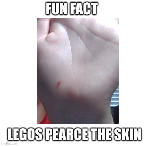 Fun Fact | FUN FACT; LEGOS PEARCE THE SKIN | image tagged in lego | made w/ Imgflip meme maker