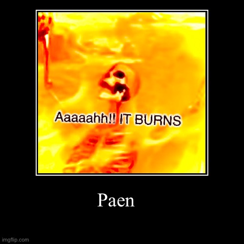 Paen | image tagged in funny,demotivationals,pain | made w/ Imgflip demotivational maker